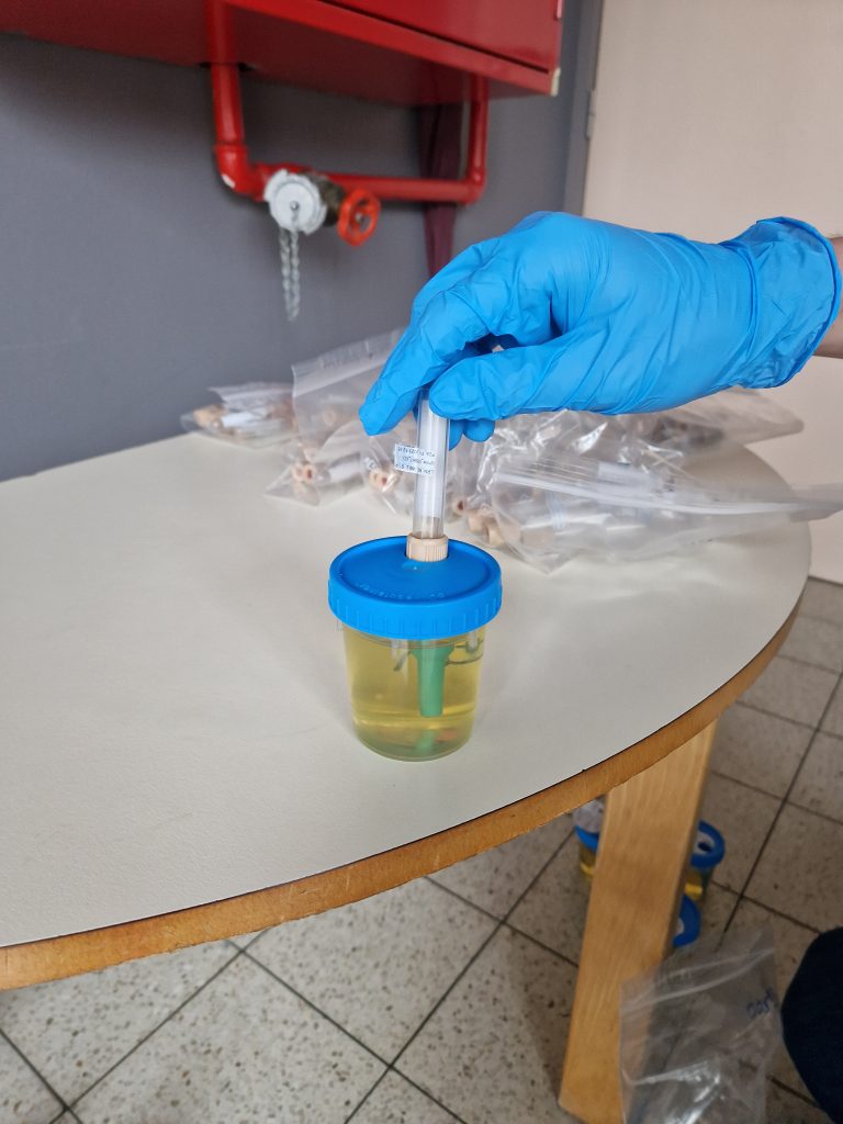 Urine collection for the LEARN project